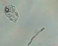 Bacillariophyceae