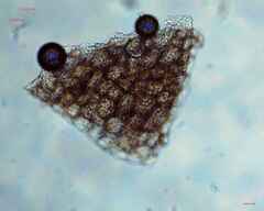 Bryopsida