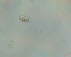 Cocconeis