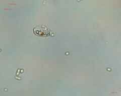 Cocconeis