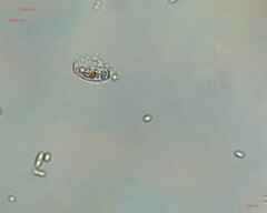 Cocconeis