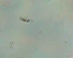 Cocconeis