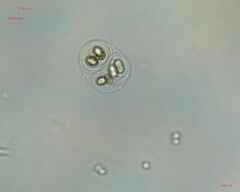 Chroococcales