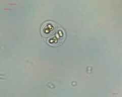Chroococcales