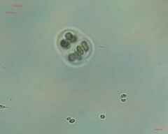 Chroococcales