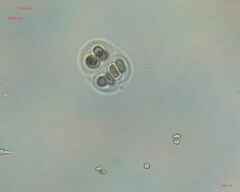 Chroococcales