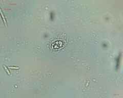Bacteria