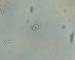 Bacteria