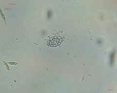 Bacteria
