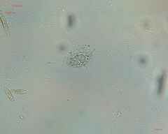 Bacteria