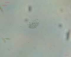 Bacteria