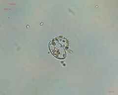 Chlorophyta