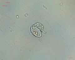 Chlorophyta