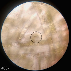 Cyanobacteria
