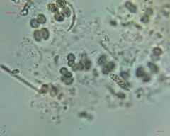 Chroococcales