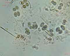 Chroococcales