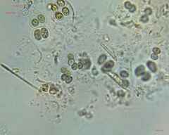 Chroococcales