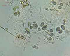 Chroococcales