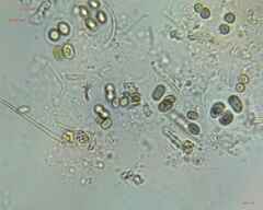 Chroococcales