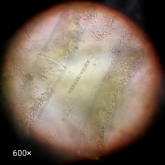 Cyanobacteria