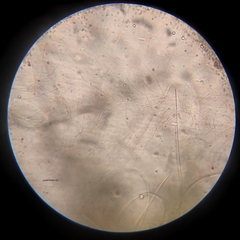Bacteria