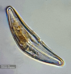 Cymbella