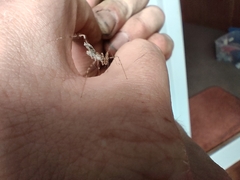 Stenolemus fraterculus