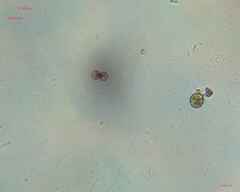 Desmidiaceae