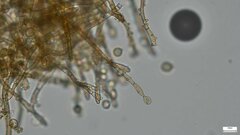 Botryobasidium