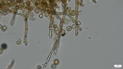 Botryobasidium