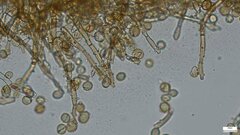 Botryobasidium
