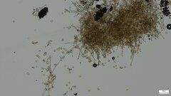 Botryobasidium