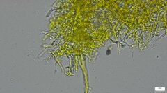 Hypomyces