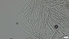 Hypomyces