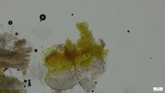 Hypomyces