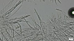 Hypomyces