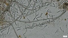 Menispora