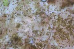 Xanthoriicola physciae