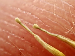 Senecio angustifolius