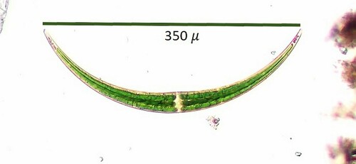 Closterium dianae — photo 1