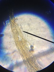 Fragilaria
