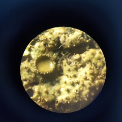 Melanohalea exasperata