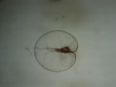 Noctiluca scintillans