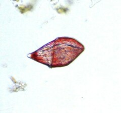Dinoflagellata