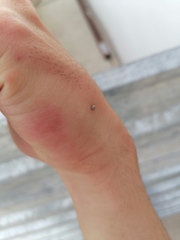 Coccinellinae