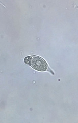 Euglenozoa