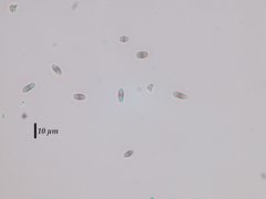 Chaenothecopsis edbergii