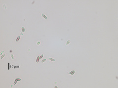 Chaenothecopsis edbergii