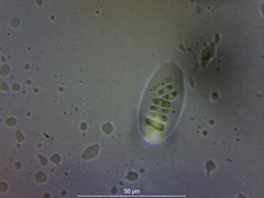 Diaporthe pterophila