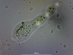 Diaporthe pterophila